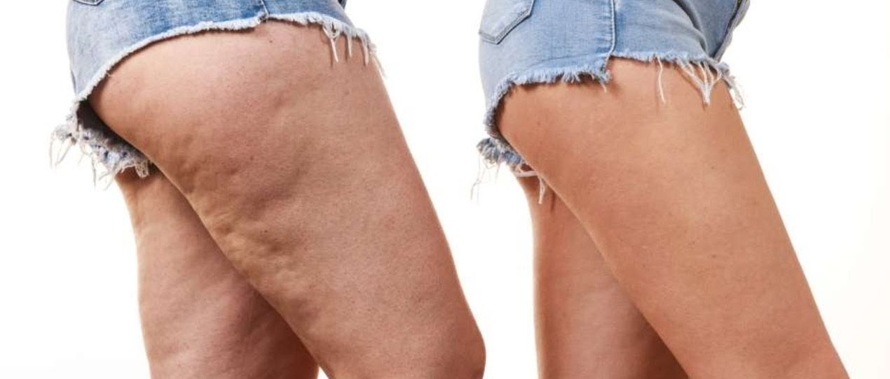 Zensabay spa movil MASAJE   ANTICELULITICO  