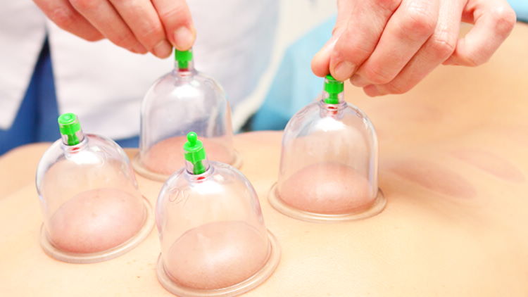 Zensabay spa movil SPA VENTOSAS Chupping,  terapia  natural. 